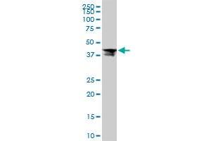 Western Blotting (WB) image for anti-Ribosomal Protein L4 (RPL4) (AA 251-350) antibody (ABIN562688)