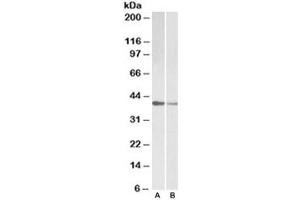 Western blot testing of human [A] and mouse [B] heart lysate with TNNT2 antibody at 0. (Cardiac Troponin T2 anticorps)