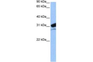 Western Blotting (WB) image for anti-Mitochondrial Ribosomal Protein L24 (MRPL24) antibody (ABIN2462302) (MRPL24 anticorps)