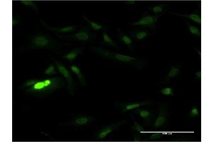 Immunofluorescence of monoclonal antibody to SUB1 on HeLa cell. (SUB1 anticorps  (AA 32-124))