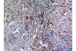 Immunohistochemistry (IHC) analysis of paraffin-embedded Human Lung, antibody was diluted at 1:100. (17beta-HSD4 (N-Term) anticorps)