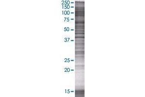 CCNDBP1 transfected lysate. (CCNDBP1 293T Cell Transient Overexpression Lysate(Denatured))