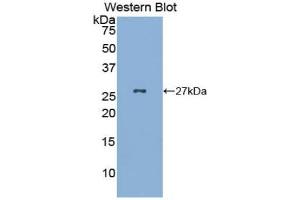 Detection of Recombinant GKN2, Mouse using Polyclonal Antibody to Gastrokine 2 (GKN2) (Gastrokine 2 anticorps  (AA 21-184))