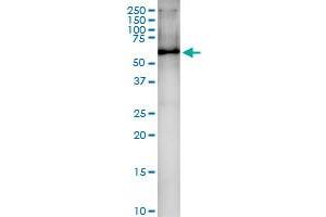 Immunoprecipitation of HDAC1 transfected lysate using anti-HDAC1 MaxPab rabbit polyclonal antibody and Protein A Magnetic Bead , and immunoblotted with HDAC1 MaxPab mouse polyclonal antibody (B01) . (HDAC1 anticorps  (AA 1-482))