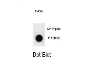 Dot blot analysis of PTEN Antibody (Phospho ) Phospho-specific Pab (ABIN6241055 and ABIN6578942) on nitrocellulose membrane. (PTEN anticorps  (pTyr176))