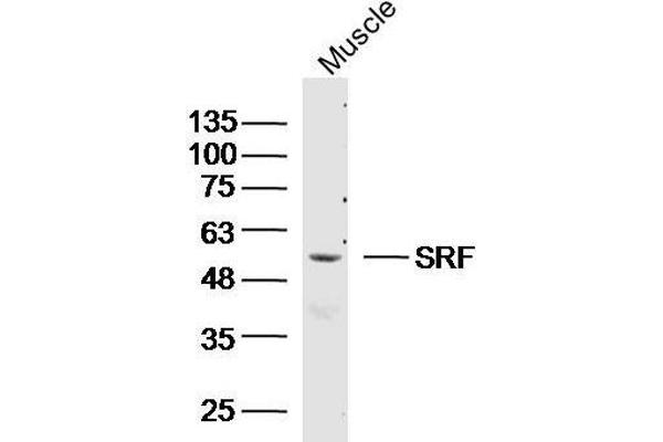 SRF anticorps  (AA 101-250)