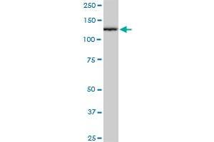 CAND1 monoclonal antibody (M03), clone 2D7. (CAND1 anticorps  (AA 1-100))