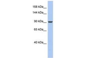 Image no. 1 for anti-PMS2 Postmeiotic Segregation Increased 2 (S. Cerevisiae) (PMS2) (AA 611-660) antibody (ABIN6743977) (PMS2 anticorps  (AA 611-660))