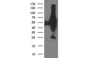 HEK293T cells were transfected with the pCMV6-ENTRY control (Left lane) or pCMV6-ENTRY XPNPEP3 (Right lane) cDNA for 48 hrs and lysed. (XPNPEP3 anticorps)