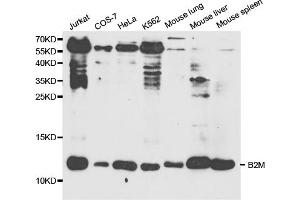 Western blot analysis of extracts of various cell lines, using B2M antibody (ABIN5970743) at 1/1000 dilution. (beta-2 Microglobulin anticorps)