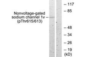 Western blot analysis of extracts from HeLa cells, using Nonvoltage-gated Sodium Channel 1 (Phospho-Thr615) Antibody. (Nonvoltage-Gated Sodium Channel 1 (AA 581-630), (pThr615) anticorps)