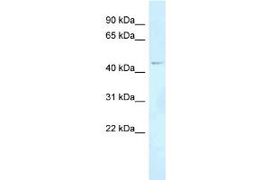 WB Suggested Anti-FOXN2 Antibody Titration: 1. (FOXN2 anticorps  (Middle Region))