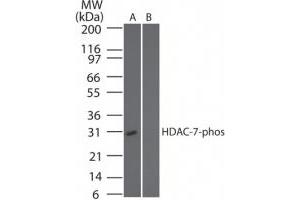 Image no. 1 for anti-Histone Deacetylase 7 (HDAC7) (pSer318) antibody (ABIN225622) (HDAC7 anticorps  (pSer318))