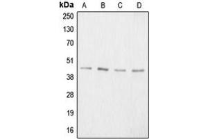 Western blot analysis of Aggrecan expression in HeLa colchicine-treated (A), mouse kidney (B), PC12 colchicine-treated (C), NIH3T3 (D) whole cell lysates. (Aggrecan anticorps  (N-Term))