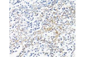 Immunohistochemistry of paraffin-embedded Human tonsil using HSD17B10 Polyclonal Antibody at dilution of 1:100 (40x lens). (HSD17B10 anticorps)