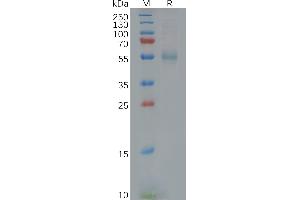 Human G Protein, His Tag on SDS-PAGE under reducing condition. (GFRA3 Protein (AA 32-374) (His tag))