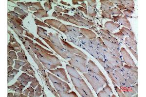 Immunohistochemistry (IHC) analysis of paraffin-embedded Rat Muscle, antibody was diluted at 1:100. (alpha-SMA (C-Term) anticorps)