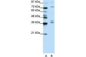 WB Suggested Anti-AKAP9 Antibody Titration:  1. (AKAP9 anticorps  (N-Term))