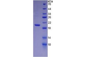 SDS-PAGE (SDS) image for Heparanase (HPSE) ELISA Kit (ABIN6574194)