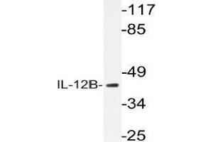 Western blot (WB) analysis of IL-12B antibody in extracts from K562 cells. (IL12B anticorps)