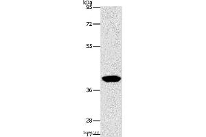 Western blot analysis of Human lymphoma tissue, using AGXT2L2 Polyclonal Antibody at dilution of 1:500 (AGXT2L2 anticorps)