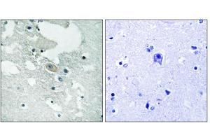 Immunohistochemistry analysis of paraffin-embedded human brain tissue using BLNK (Phospho-Tyr84) antibody. (B-Cell Linker anticorps  (pTyr84))