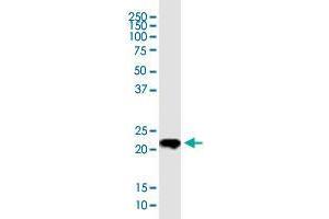 Western Blotting (WB) image for anti-Twist Homolog 1 (Drosophila) (TWIST1) (AA 100-202) antibody (ABIN563296)