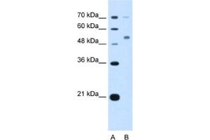 Western Blotting (WB) image for anti-Cerebellar Degeneration-Related Protein 2, 62kDa (CDR2) antibody (ABIN2463409) (CDR2 anticorps)