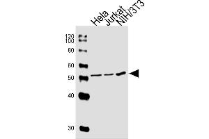 Sample Tissue/Cells lysates probed with PPARA (1331CT894. (PPARA anticorps)