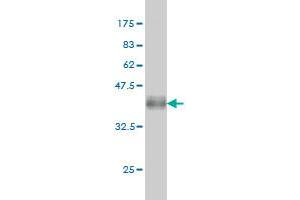 Western Blot detection against Immunogen (37. (FGFR2 anticorps  (AA 621-723))