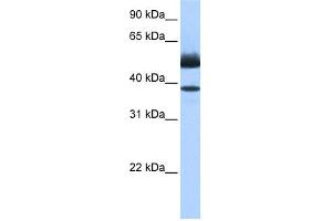 WB Suggested Anti-LIPJ Antibody Titration: 0. (LIPJ anticorps  (C-Term))