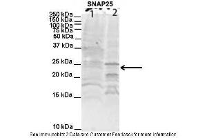 Lanes:   1. (SNAP25 anticorps  (C-Term))