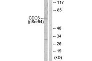 Western blot analysis of extracts from COS7 cells treated with EGF 200ng/ml 30', using CDC6 (Phospho-Ser54) Antibody. (CDC6 anticorps  (pSer54))