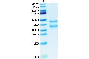 Mouse PK-1/PROK1 on Tris-Bis PAGE under reduced condition. (PKLR Protein (AA 20-105) (Fc Tag))