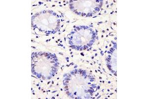 IHC-P analysis of human colon tissue. (PELP1 anticorps)