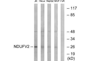 Western blot analysis of extracts from Jurkat cells, HeLa cells, HepG2 cells and MCF-7 cells, using NDUFV2 antibody. (NDUFV2 anticorps  (Internal Region))