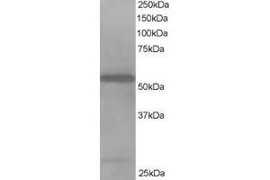 Western Blotting (WB) image for anti-Drebrin-Like (DBNL) antibody (ABIN5900113) (DBNL anticorps)