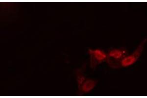 ABIN6269039 staining MCF-7 cells by IF/ICC. (Activin A Receptor Type IB/ALK-4 anticorps  (Internal Region))