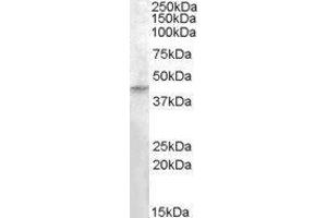 Western Blotting (WB) image for Ras Association (RalGDS/AF-6) Domain Family (N-terminal) Member 8 (RASSF8) peptide (ABIN369749) (Ras Association (RalGDS/AF-6) Domain Family (N-terminal) Member 8 (RASSF8) Peptide)