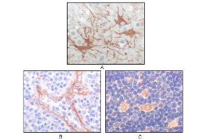 Immunohistochemical analysis of paraffin-embedded human cerebrum tumor (A), endothelium of vessel (B), lymphocyte of thymus(C), showing cytoplasmic localization using FES mouse mAb with DAB staining. (FES anticorps)