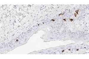 Immunohistochemistry (IHC) image for anti-CD207 Molecule, Langerin (CD207) antibody (ABIN7538905) (CD207 anticorps)