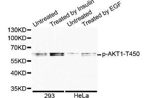 Western blot analysis of extracts of various cell lines, using Phospho-AKT1-T450 antibody. (AKT1 anticorps  (pThr450))
