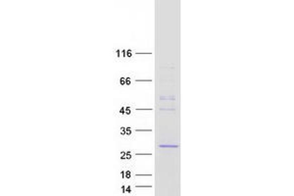 Methyltransferase Like 21D (METTL21D) (Transcript Variant 2) protein (Myc-DYKDDDDK Tag)