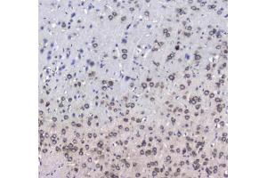 IHC testing of FFPE rat brain tissue with L1CAM antibody at 1ug/ml. (L1CAM anticorps)