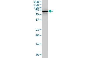 Western Blotting (WB) image for anti-Histone Deacetylase 1 (HDAC1) (AA 1-482) antibody (ABIN516392)