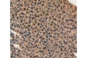 IHC-P analysis of liver tissue, with DAB staining. (Midkine anticorps  (AA 22-140))