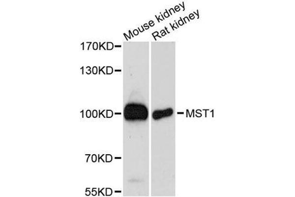 MST1 anticorps  (AA 200-500)