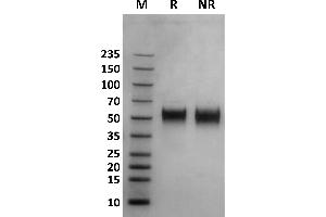 Human Fc gamma RIIIa / CD16a (176V) protein on Coomassie Blue stained SDS-PAGE under non-reducing (NR) and reducing (R) conditions. (FCGR3A Protein (AA 17-208) (His-Avi Tag,Biotin))