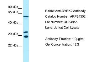 Western Blotting (WB) image for anti-Dual-Specificity tyrosine-(Y)-phosphorylation Regulated Kinase 2 (DYRK2) (C-Term) antibody (ABIN970575) (DYRK2 anticorps  (C-Term))