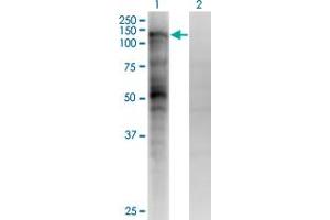 Western Blot analysis of MSH2 expression in transfected 293T cell line by MSH2 monoclonal antibody (M04), clone 4F11. (MSH2 anticorps  (AA 835-934))